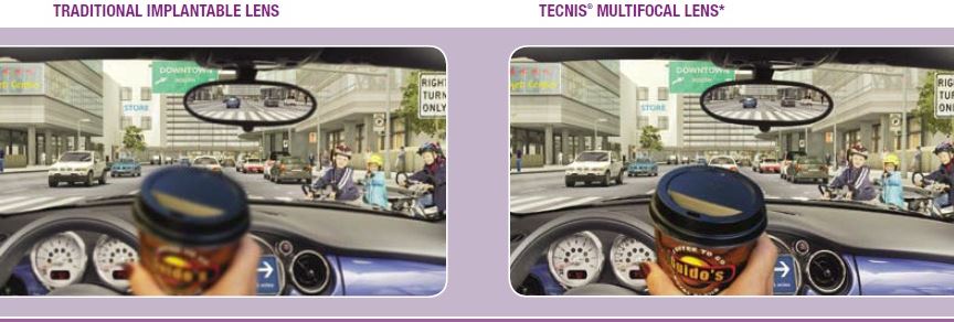 Washington DC & Glenn Dale, MD Ophthalmologist Blog